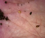 Annual Bluegrass Weevil